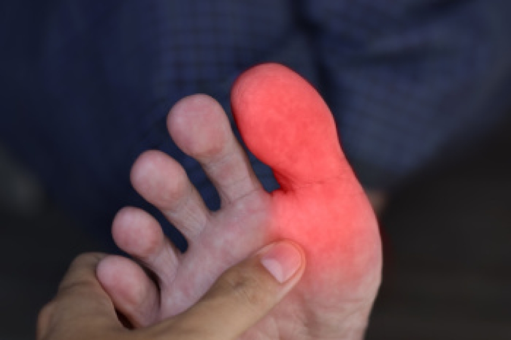 Treatment Options for Hallux Rigidus