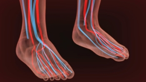 Can Poor Circulation Be Prevented?