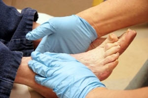 Treatment Options for Diabetic Nerve Pain