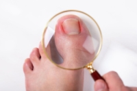 Understanding Ingrown Toenails in Kids