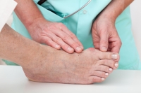 Description and Causes of a Bunion